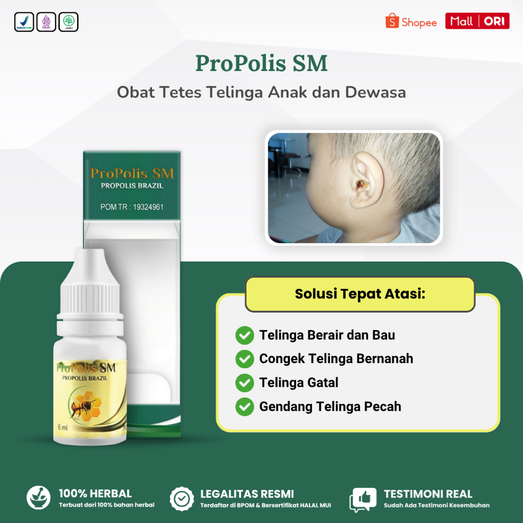 Obat Tetes Telinga Anak dan Dewasa, Telinga Berair Bernanah Bau Congek Curek Gatal Propolis SM
