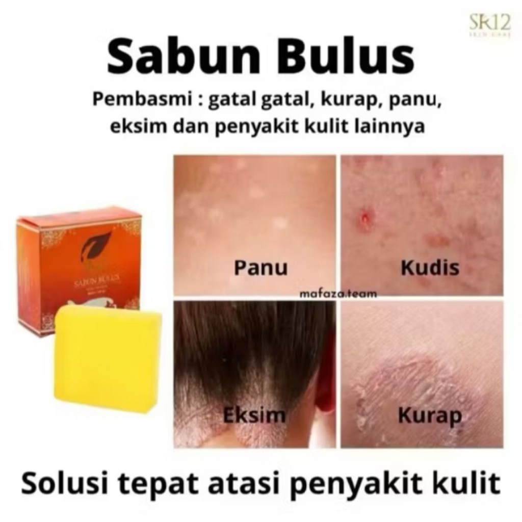 SABUN BULUS SR12/SABUN MENGHILANGKAN GATAL PADA ANAK-ANAK DAN DEWASA/SABUN MEMUDARKAN STRECMARK/ SAB