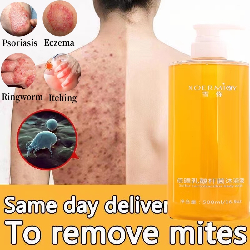 pemutih miss v sabun pemutih badan pemutih badan pemutih badan sabun 520ml Pemutih seluruh tubuh Sho