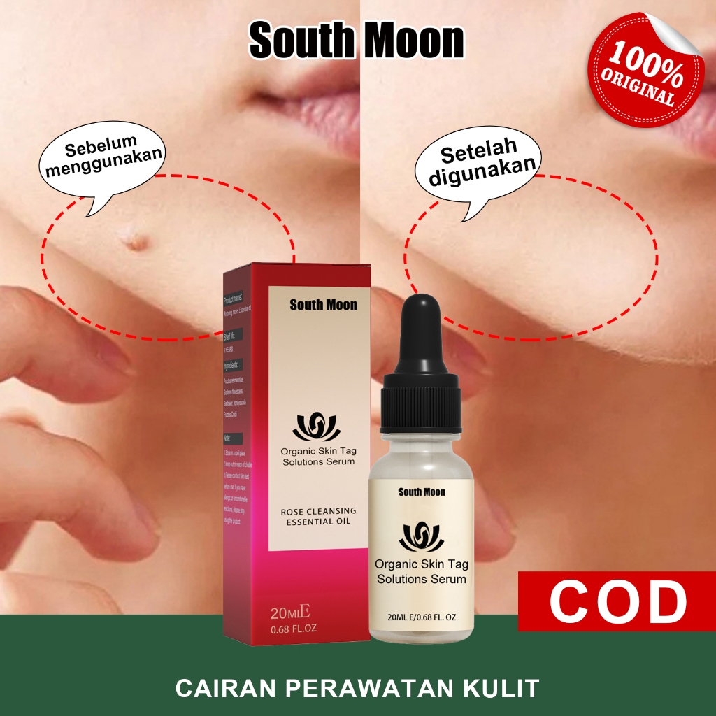 EELHOE【COD】Wart Removal Serum 20ml Penghilang Tahi Lalat Rose Serum Skin Tag Remover Penghilang Kuti