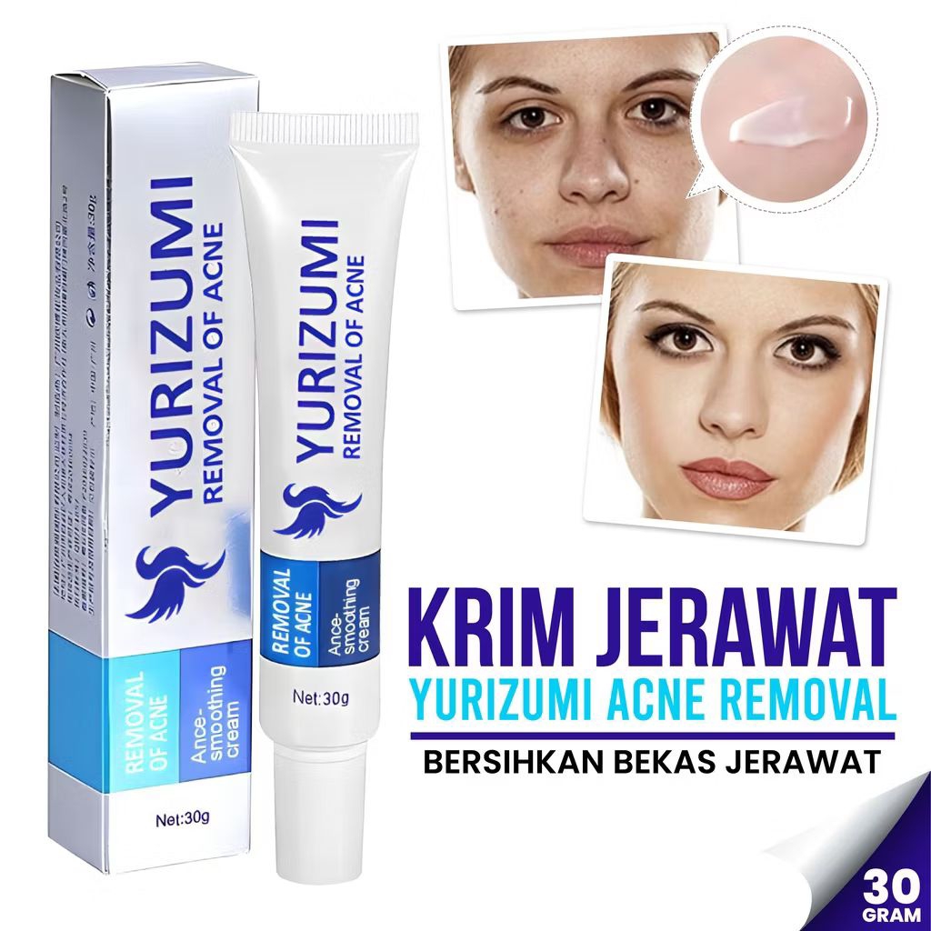 (COD) [ BPOM ] BIOAQUA X YURIZUMI PURE SKIN ACNE CREAM Obat Jerawat Paling Ampuh Menghilangkan Jeraw