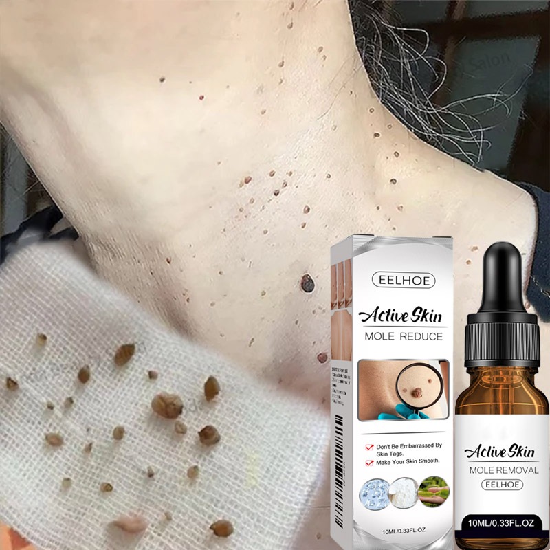 Wart Remover Serum  Obat Kutil Paling Ampuh Skin Tag Remover Penghilang Tahi Lalat Penghilang Kutil