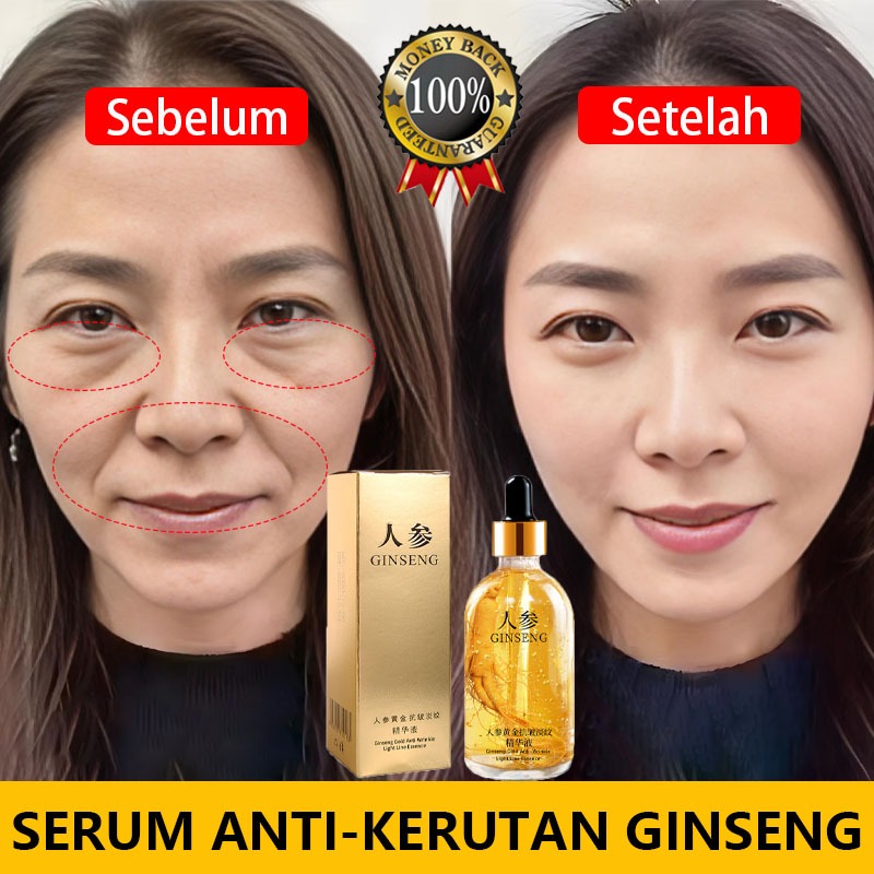 Brightening serum  Retinol serum Serum anti aging Anti aging skincare Serum flek hitam membandel Ant