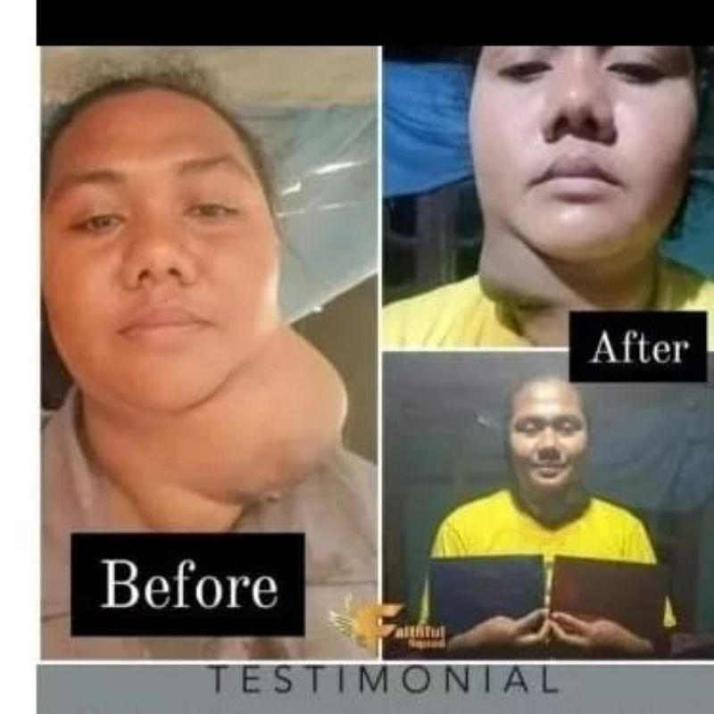 

2 BOX SOP Subarashi Utsukushhii Gold Hikari - Diabetes Stroke Maag Jantung Gagal Ginjal Kanker