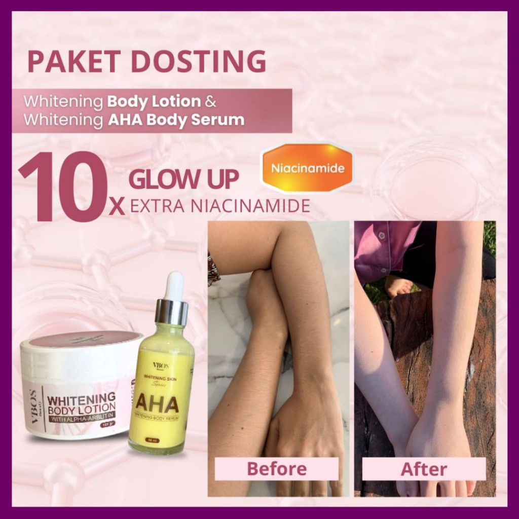 WHITENING BODY LOTION|VBOS WHITENING BODY LOTION DOSTING||LOTION DOSTING