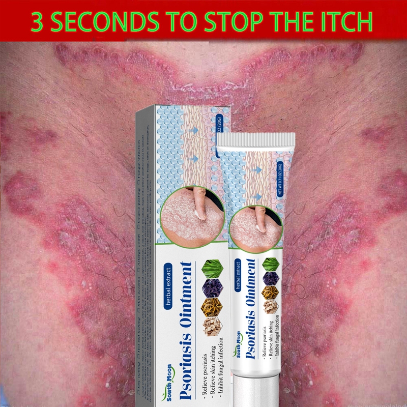 Obat kurap Obat gatal selangkangan 0bat gatal gatal di kemaluan Salep gatal eksim paling ampuh 20g S