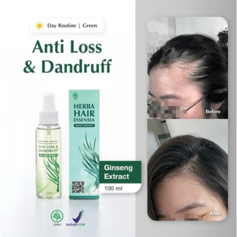 Hair Tonic Essential Green / Hair Tonic Essential Hijau 100 ml