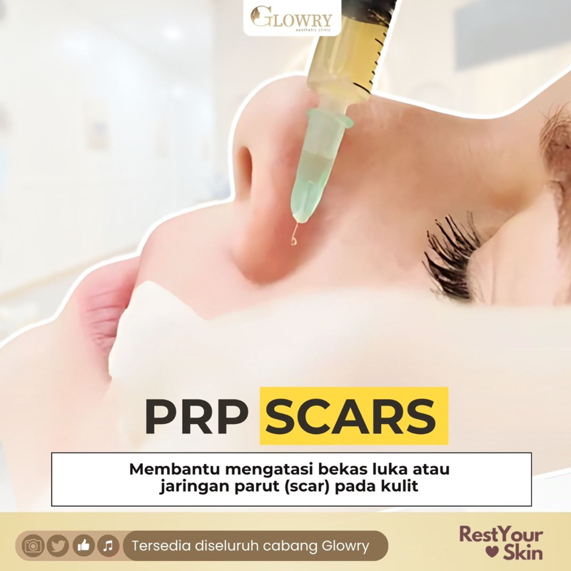 GLOWRY || PRP SCARS || WAJAH BOPENG