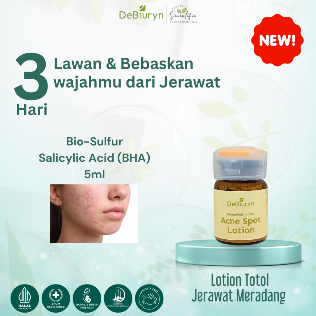 DeBiuryn Removind Acne Spot Drying Lotion Totol Jerawat Merah Meradang Mengeringkan Jerawat Bruntusa