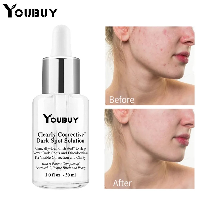 COD Youbuy Blemish Whitening Essence Original BPOM | Serum Pemutih Wajah dan Pemudar Bekas Jerawat