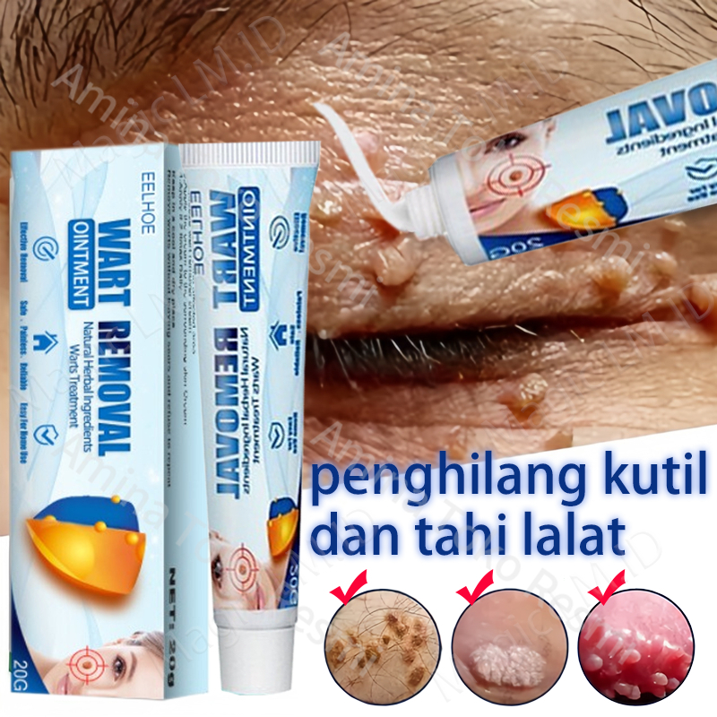 Kutil Salep Obat Kutil Dan Tahi Lalat Obat Penghilang Kutil Papiloma Wajah Kutil Leher Penghilang Ku