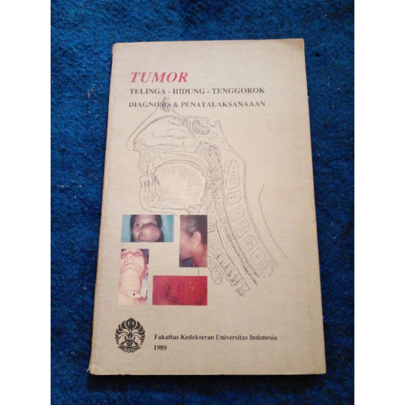 TUMOR telinga hidung tenggorok diagnosis & penatalaksanaan       h