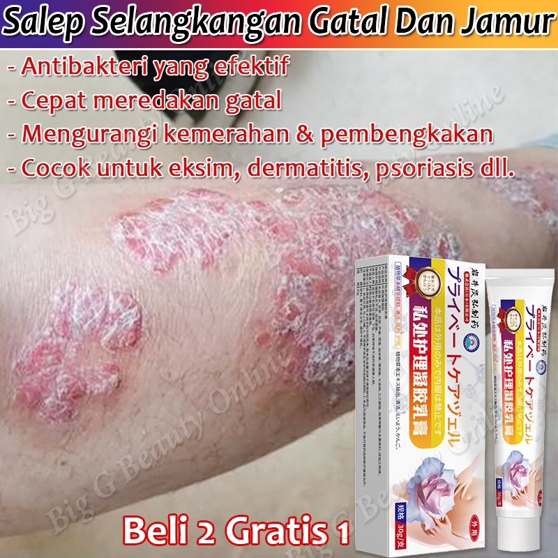 Salep Selangkangan Gatal Dan Jamur Salep Eksim Jamur Dermatitis Psoriasis Eksim Obat Gatal Gatal Amp