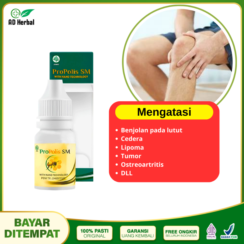 Obat Benjolan Lutut, Kista Baker, Benjolan Belakang Lutut Terlaris Propolis SM