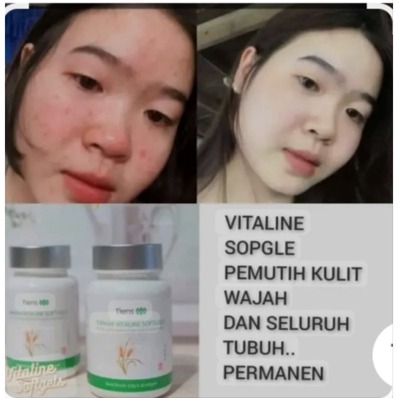 VITALINE SOFTGELS TIENS