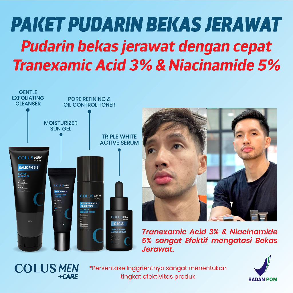 COLUS MEN Paket Skincare PUDARIN BEKAS JERAWAT | Skincare Pria Niacinamide 5%| Sabun Muka Pria | Ski