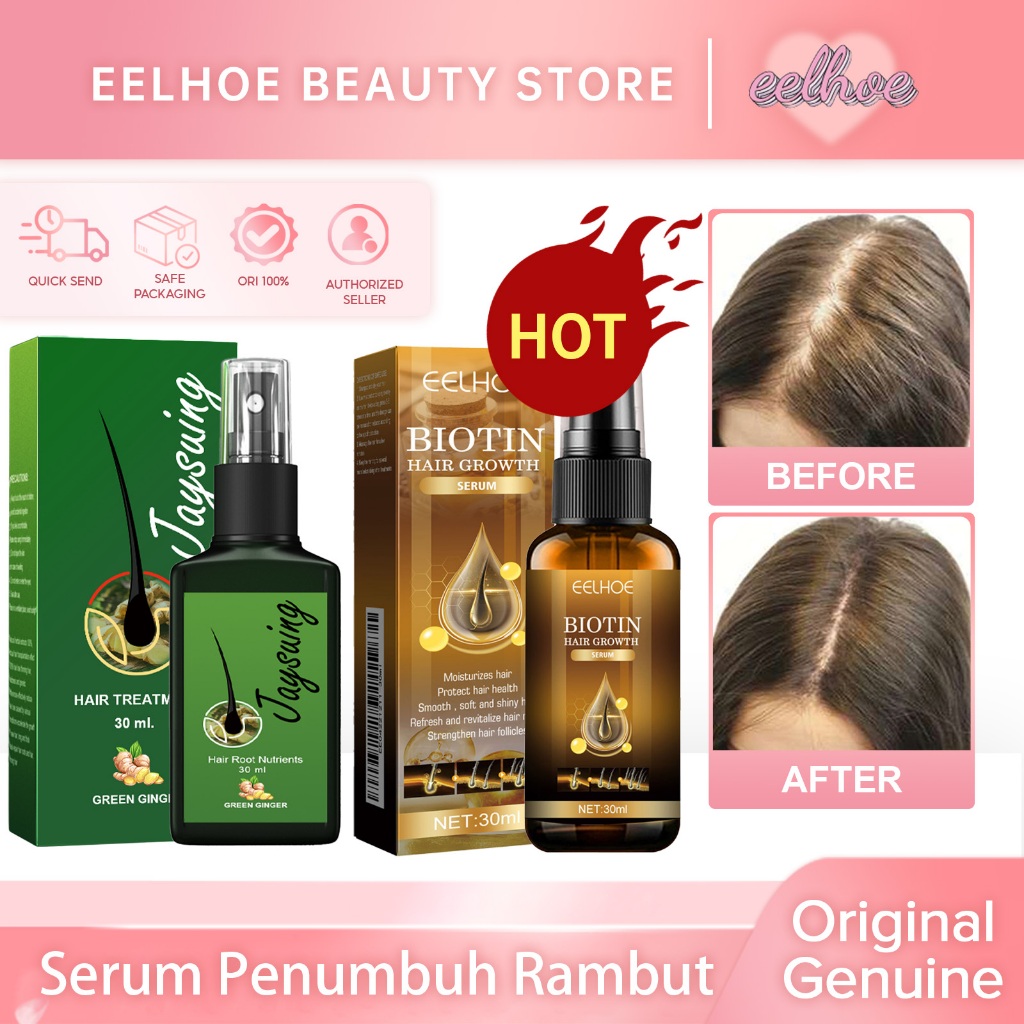 Jaysuing Serum Penumbuh Rambut Hair Growth Spray Obat Penumbuh Rambut Penumbuh Rambut Botak Serum Ha