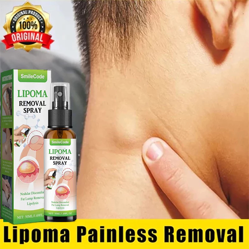 Salep lipoma 50ml Semprot Lipoma krim salep benjolan salep limfatik krim obat benjolan Lipoma Salep 
