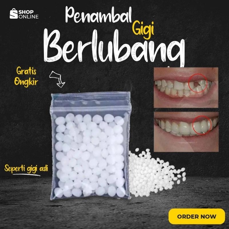 Penambal Gigi 1000 Butir - Temptooth Gigi Palsu 1000 Butir - Tem