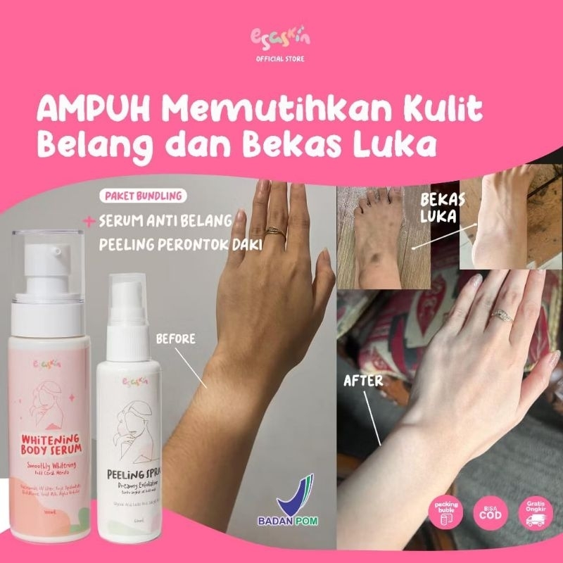 Esaskin Official Beauty - Esa Skin 1 Paket Whitening Body Serum Dan Peeling Spray