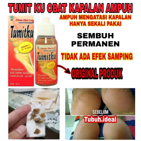 Grosir Tumitku Obat Kaki Pecah Original 100% 1 Karton isi 120 Botol