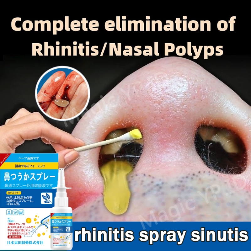 New nasal spray sinusitis spray obat sinusitis hidung semprot hidung tersumbat semprotan sinusitis