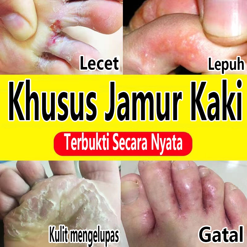 Penghilang Bau Kaki Semprotan Deodoran Kaki 30ML Semprotan penghilang bau Kaki menghilangkan bau kak