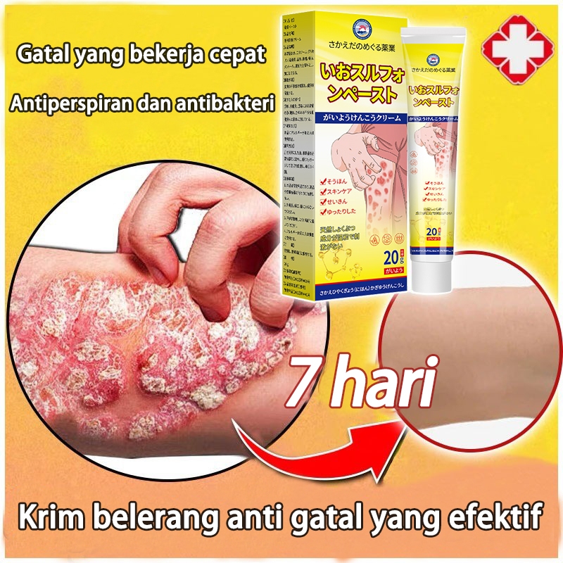 Krim anti gatal paling ampuh, obat gatal selangkangan,psoriasis cream20g, salep antigatal obat cina 