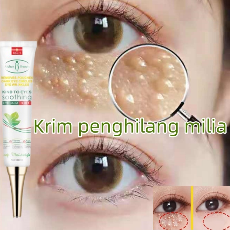 Krim penghilang milia obat milia penghilang milia paling ampuh Salep Milia di Bawah Mata penghilang 