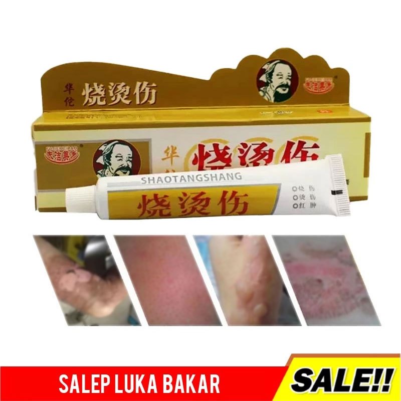 Huatuo Salep Herbal Obat Luka Bakar Minyak Panas Kena Air Panas Kulit Melepuh Ampuh