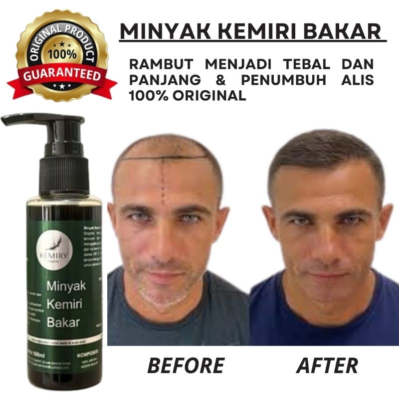 COD Shampo Kemiri Penumbuh Rambut / Penguat akar Rambut / Shampo Penghilang Uban 100ml