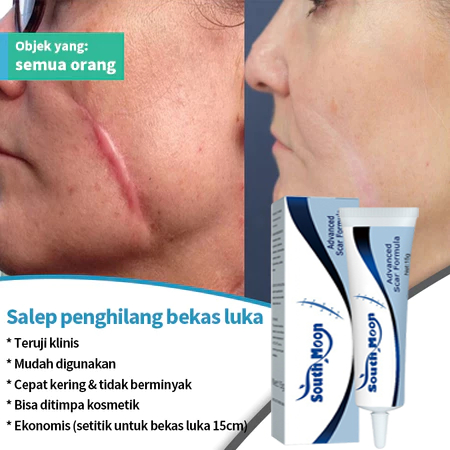 Penghilang bekas luka hitam koreng Penghilang bekas luka di kaki Penghilang Bekas cacar Bekas gigita