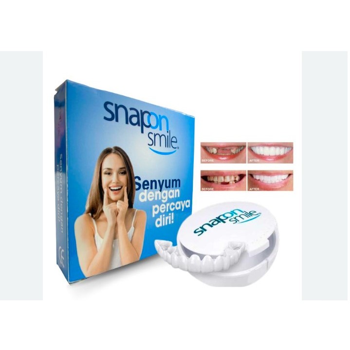 snap on smile