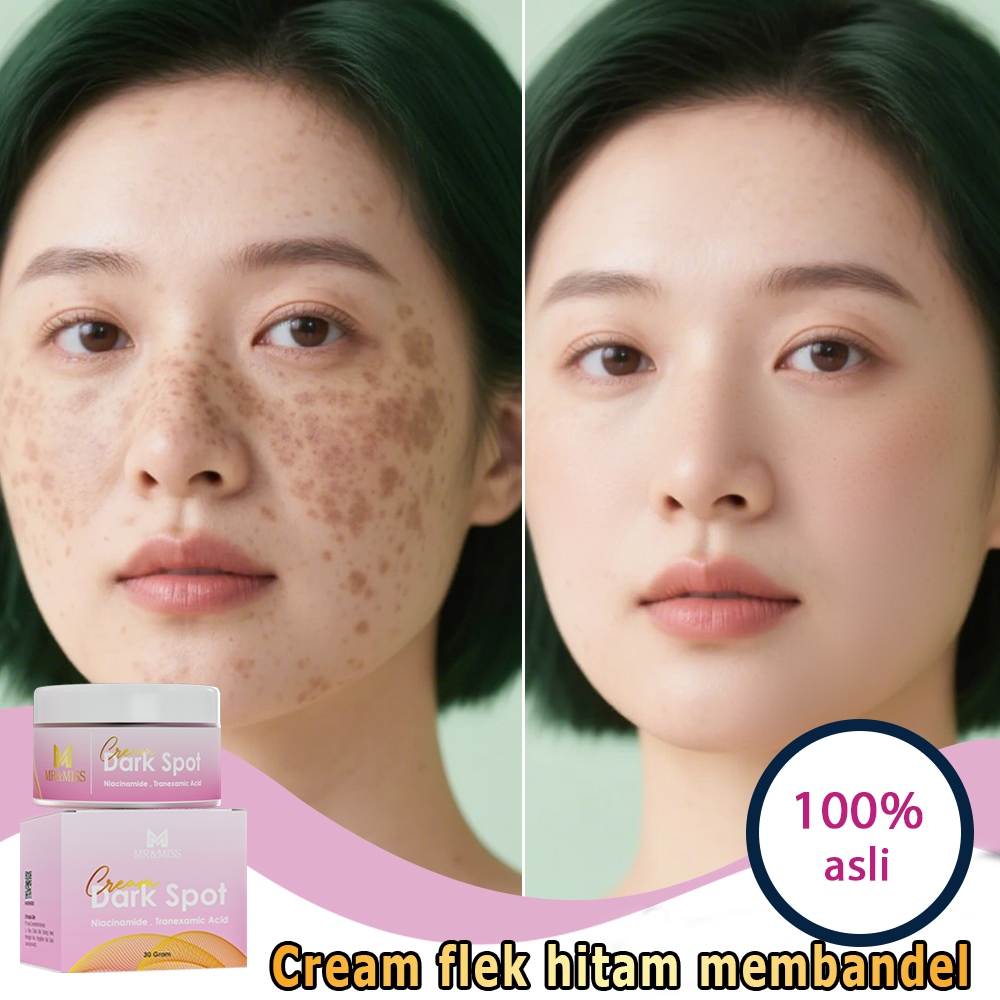 Salep flek hitam membandel menghilangkan flek hitam di wajah krim pemutih wajah bpom 30g