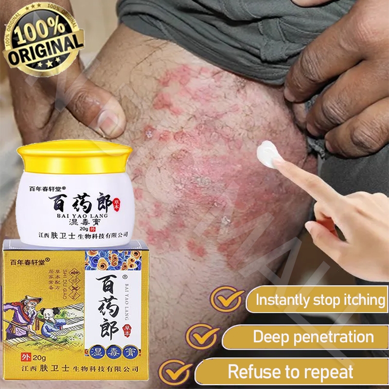 Salep eksim Obat eksim Salep gatal paling ampuh Salep gatal pada miss v Salep gatal selangkangan Oba