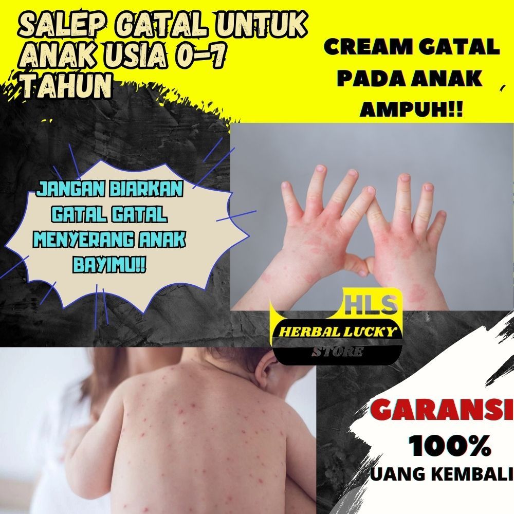 salep gatal anak