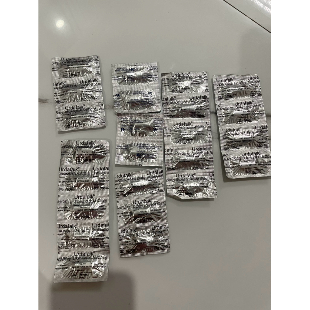 Urdafalk batu empedu