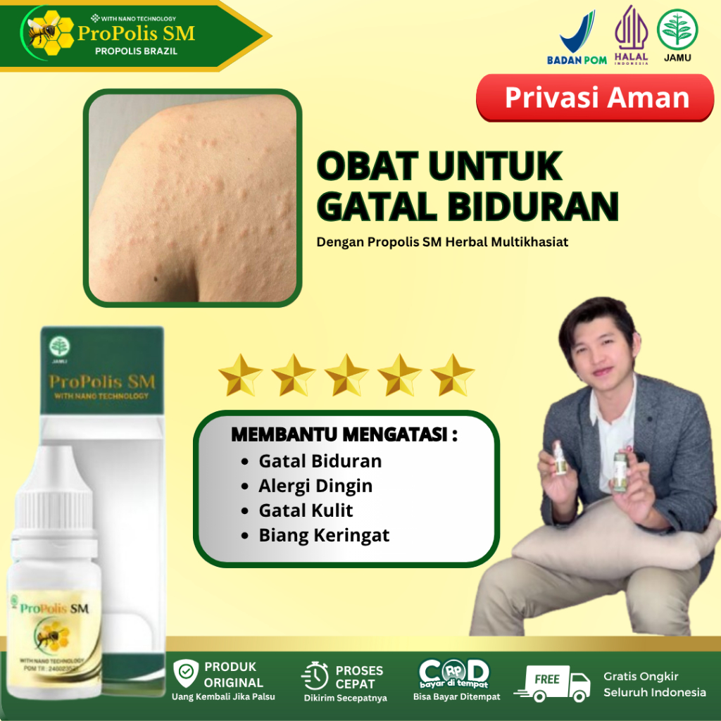 Propolis SM - Obat Biduran Gatal Alergi Dingin, Alergi Gatal Kulit Biduran, Kaligata Atasi Dengan Pr