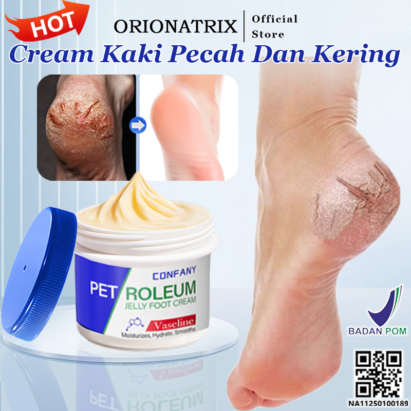 Orionatrix Cream Kaki Pecah Dan Kering Ampuh Bpom Obat Kaki Pecah Pecah Krim Kaki Pecah Dan Kering