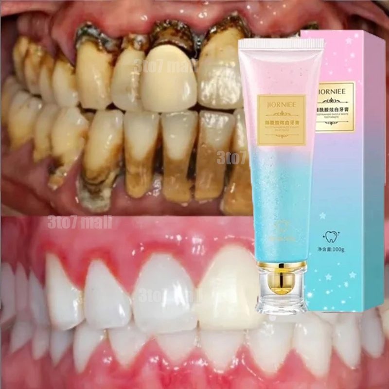 odol pemutih gigi dan karang gigi pasta gigi pemutih toothpaste whitening odol memutihkan gigi gigi