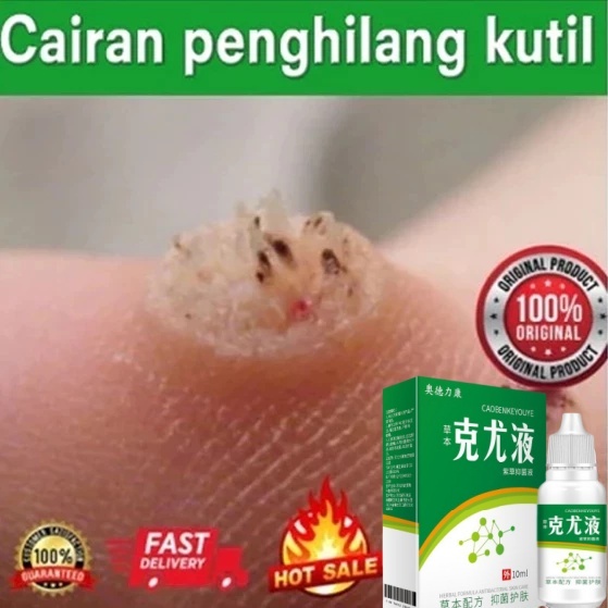 obat kutil obat kutil ampuh  salep kutil paling ampuh   Perontok Kutil di Leher, Wajah, Tangan, Kaki
