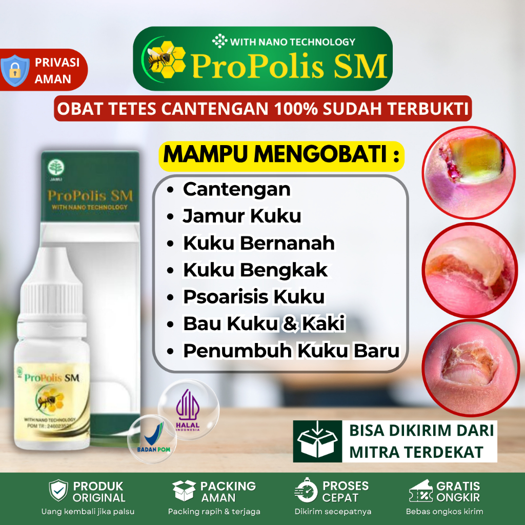 Obat Tetes Cantengan, Cantengan Jempol Kaki, Jamur Kuku Kaki Rusak, Kuku Kaki Bernanah, Kuku Kaki Be