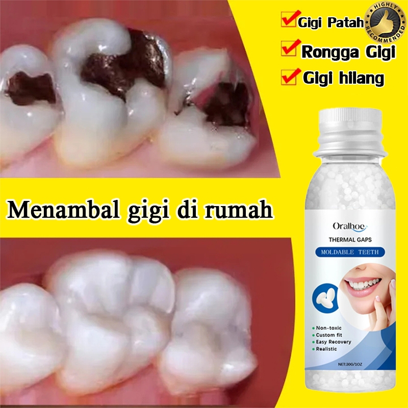 【Baru diluncurkan pada tahun 2025】gigi ompong penambal，Perbaiki gigi Anda dengan cepat（gigi ompong p