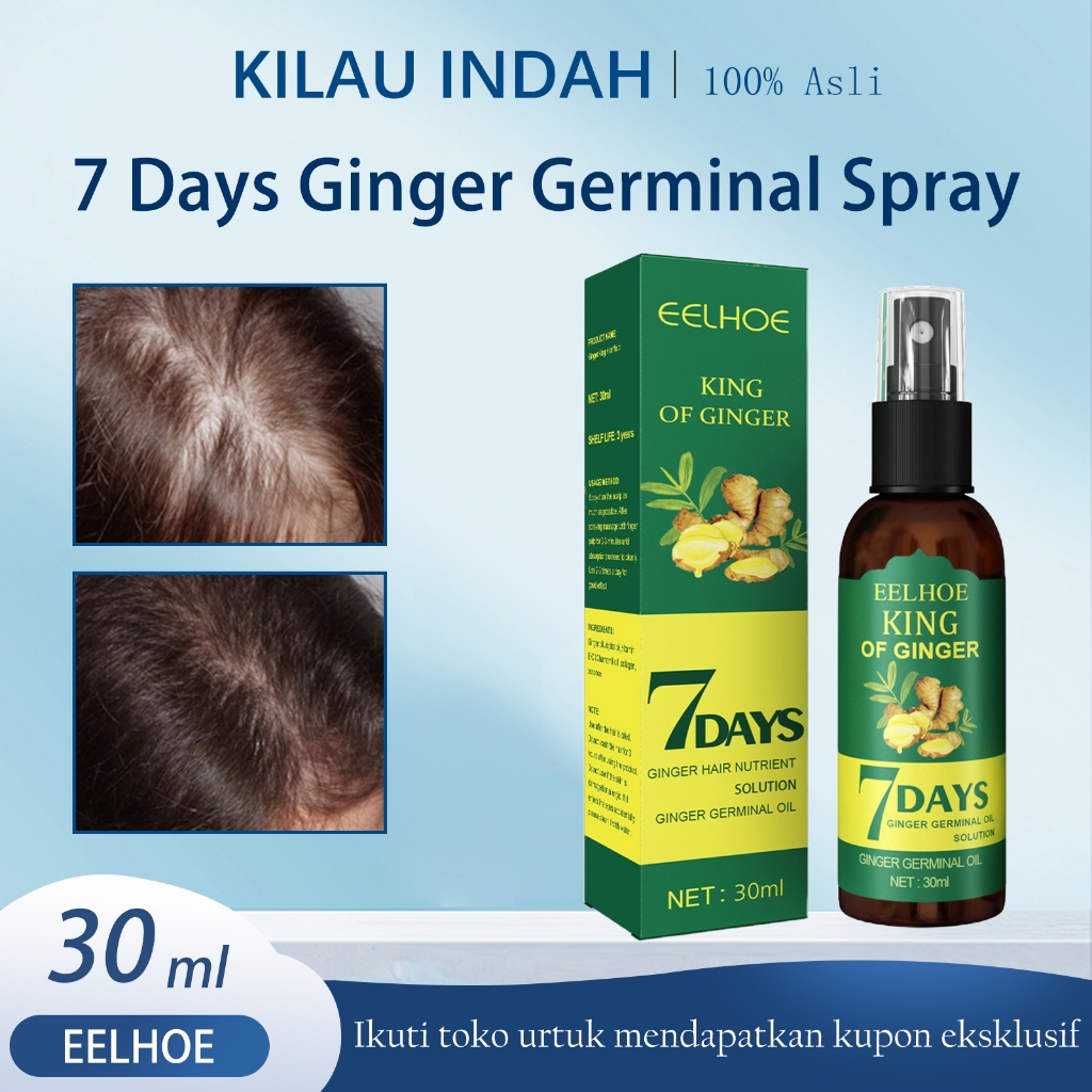 【100%Ori/COD】EELHOE King Of Ginger 7 Days Ginger Oil 30ml - Pertumbuhan Rambut