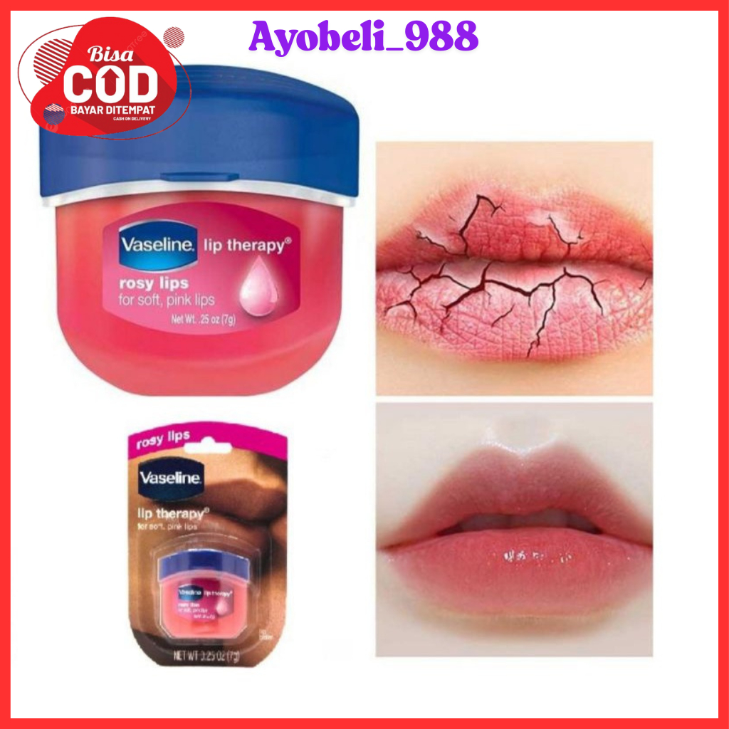 Vaseline Therapy Bibir Kering/Lip Balm/Lip Therapy