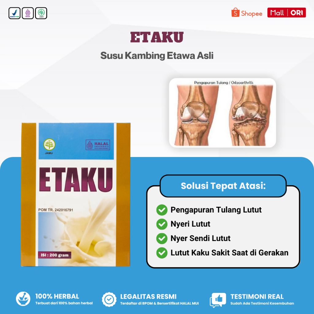 

Obat Pengapuran Tulang Lutut, Osteoarthritis, Nyeri Lutut, Radang Sendi - Etaku Susu Kambing Etawa