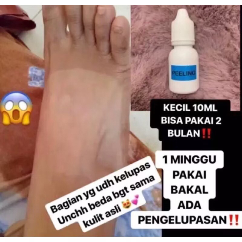 Peeling Badan 15% Peeling Kelupas Badan Terampuh Tidak Sakit Dan Perih Isi 10ml