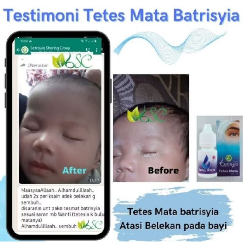 tetes mata bayi obat tetes mata merah obat tetes mata bayi tetes mata bayi tetes mata merah tetes ma
