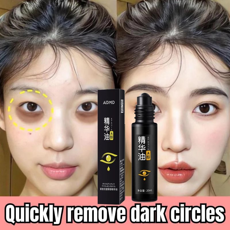 PRODUK ORIGINAL - Eye cream menghilangkan milia menghilangkan keriput di mata dan kantung mata