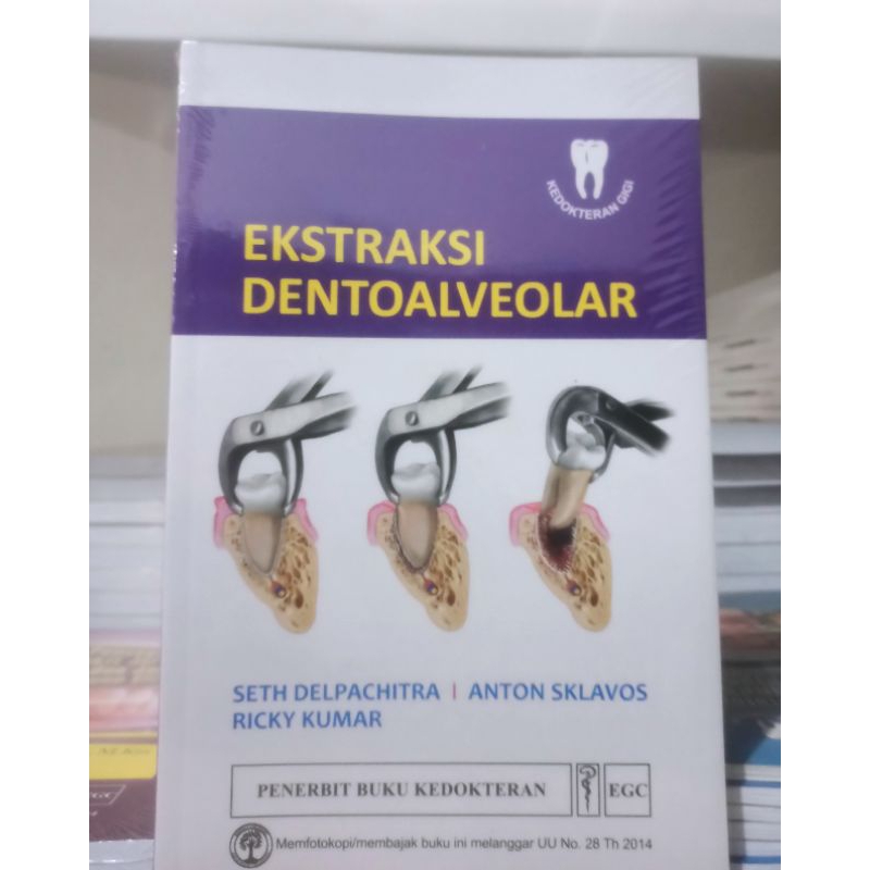 Ekstraksi Dentoalveolar